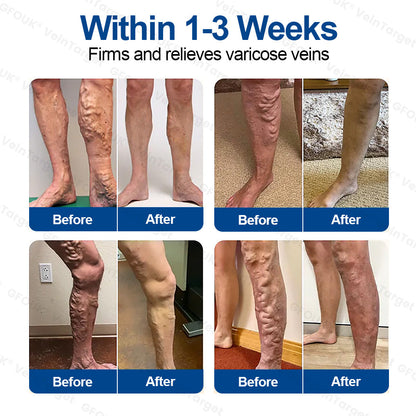 🇺🇸👨‍⚕️👍✅GFOUK® VeinTarget Microneedle Patch⚡Instant Relief, Long-Term Results